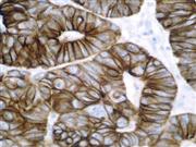 Cytokeratin 35BH11 (35BetaH11), MMab THUMBNAIL