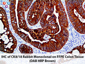 PolyDetector DAB HRP Brown Buffer MAIN