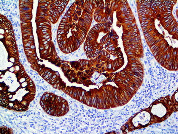 PolyDetector DAB HRP Brown Buffer THUMBNAIL