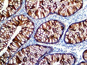 Cytokeratin 8 (EP17), RMab MAIN