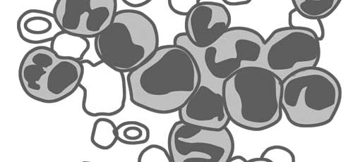 ZytoDot Probes -   Chronic Myelogenous Leukemia