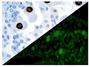 Cytomegalovirus (8B1.2, 1G5.2 & 2D4.2), MMab MAIN