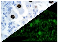 Cytomegalovirus (8B1.2, 1G5.2 & 2D4.2), MMab MAIN