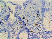 CTLA-4 / CD152 (RBT-CTLA-4), RMab THUMBNAIL