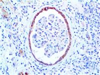 Cadherin-6 (EP217), RMab MAIN