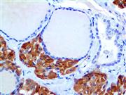Calcitonin (Polyclonal), RPab THUMBNAIL