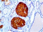 Calcitonin (EP92), RMab THUMBNAIL