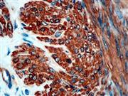 Calponin (BSB-20), MMab THUMBNAIL