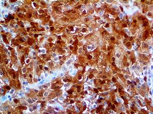 CALB2, 29 kDa calbindin, CAB29, CAL2, calbindin 2, calbindin 2 29kD calretinin, calbindin D29K, calretinin, CR, anti-cr, MAIN