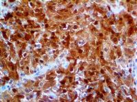 CALB2, 29 kDa calbindin, CAB29, CAL2, calbindin 2, calbindin 2 29kD calretinin, calbindin D29K, calretinin, CR, anti-cr, MAIN