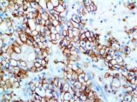 Carbonic Anhydrase 9 (EP161), RMab MAIN
