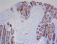 claudin 4, claudin-4, CLDN4, claudin4, anti-claudin-4, anti claudin-4, anti-claudin 4 MAIN