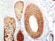 Claudin-1 (Polyclonal), RPab THUMBNAIL