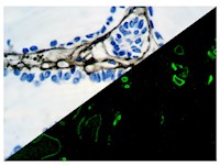 Collagen Type IV (CIV22), MMab MAIN