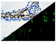 Collagen Type IV (CIV22), MMab THUMBNAIL