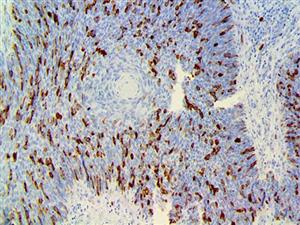CNB1, anti-cyclin B1, anti cyclin B1, anti-CCNB1, anti CCNB1, CCNB, cyclin B1, G2 mitotic specific cyclin B1 MAIN