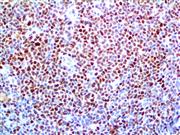 Cyclin D1 (RM241), RMab THUMBNAIL