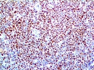 Cyclin D1 (RBT-14), RMab MAIN