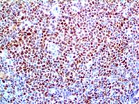 Cyclin D1 (RBT-14), RMab MAIN