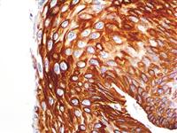 Cytokeratin 14 (LL002), MMab MAIN