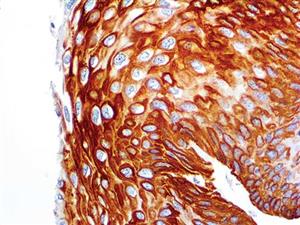 Cytokeratin 14 (RM328), RMab MAIN