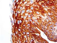 Cytokeratin 14 (RM328), RMab MAIN