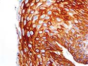 Cytokeratin 14 (RM328), RMab THUMBNAIL