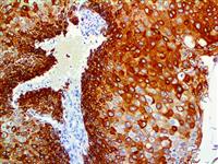 Cytokeratin 17 (BSB-33), MMab MAIN