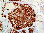 Cytokeratin 19 (BSB-34), MMab THUMBNAIL