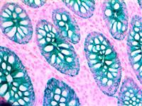 ck oscar, cytokeratin oscar, ck-oscar MAIN