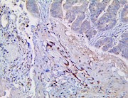 CD167, DDR1, discoidin domain receptor tyrosine kinase 1, anti-DDR1, anti DDR1, TRK E, TRKE, Tyrosine kinase DDR THUMBNAIL
