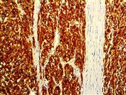 DOG-1 (RBT-DOG1), RMab THUMBNAIL