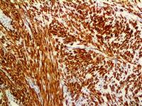 Desmin (D33), MMab MAIN