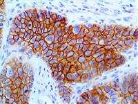 Desmoglein-3 (EP306), RMab MAIN