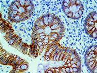 E-Cadherin (EP6), RMab MAIN