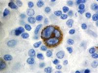 Epstein Barr Virus LMP-1 (CS1-4), MMab MAIN