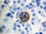Epstein Barr Virus LMP-1 (CS1-4), MMab THUMBNAIL