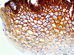 EGFR Phospho (EP11), RMab MAIN