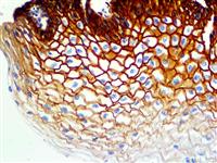 EGFR Phospho (EP11), RMab MAIN