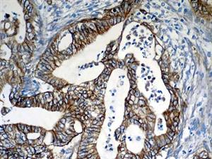 EGFR (31G7), MMab MAIN