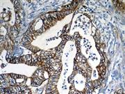 EGFR (31G7), MMab THUMBNAIL