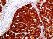 EMA (E29), MMab THUMBNAIL