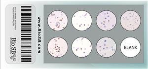 7-Core ER/PR Cell Line Microarray MAIN