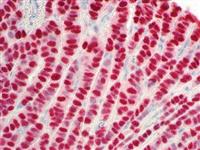 Estrogen Receptor (BSB-1), MMab MAIN