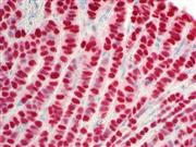 Estrogen Receptor (BSB-1), MMab THUMBNAIL