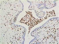 ERG (EP111), RMab MAIN