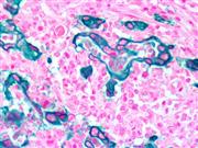 EpCAM / Epithelial Specific Antigen (MOC-31), MMab THUMBNAIL