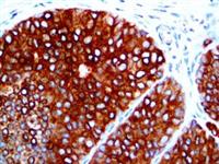 EpCAM / Epithelial Specific Antigen (Ber-EP4), MMab MAIN