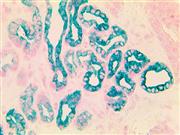 TintoFast EpCAM (Ber-EP4), MMab THUMBNAIL