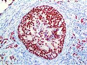 Estrogen Receptor (RBT-11), RMab THUMBNAIL